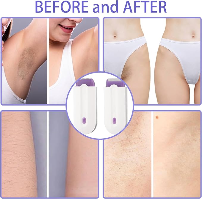 USB Rechargeable Hair Remover